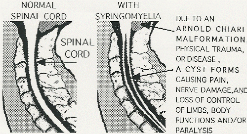 photo of spine